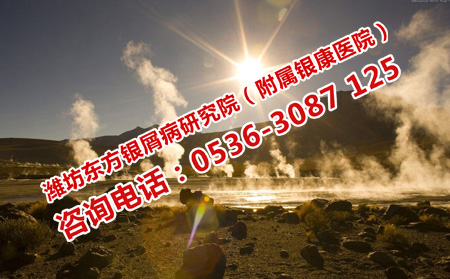 牛皮癣怎么能很好的稳定住