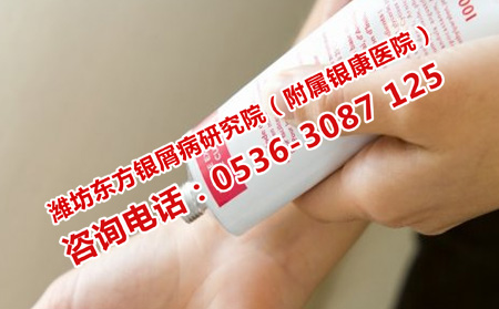用激素治疗轻微牛皮癣