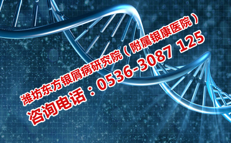 济南银屑病医院紫外线光疗
